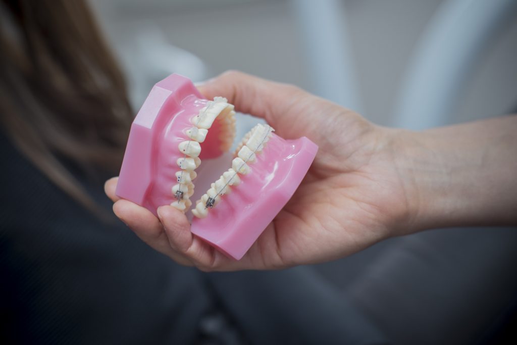 Braces Family Dental Care Doncaster East