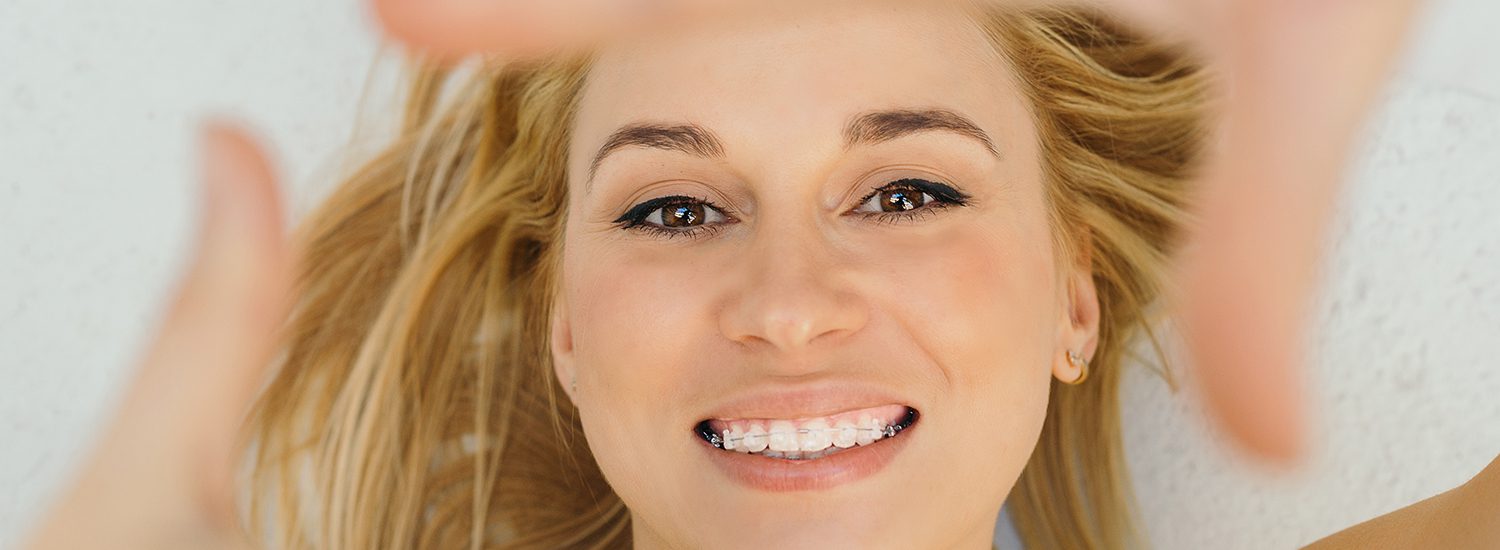 Adult Orthodontics, Family Dental Care